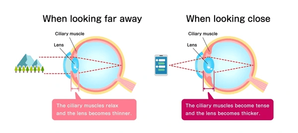 Two side-by-side diagrams showing the eye focusing on distant vs near objects, illustrating the differences in ciliary muscle, suspensory ligament, and lens states