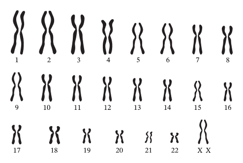 Human karyotype showing all 23 pairs of chromosomes arranged by size, with sex chromosomes (XX or XY) clearly labeled at the end