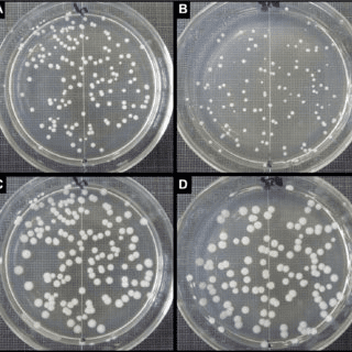 Petri dish showing bacterial colonies, with transformed bacteria growing on antibiotic-containing medium while non-transformed bacteria fail to grow